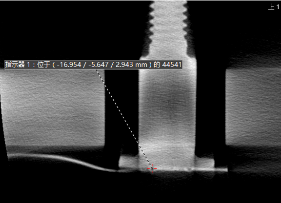 工業CT檢測案例